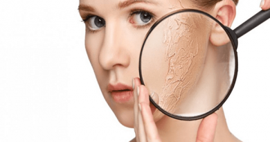 Da khô đắp mặt nạ gì - 4 loại mặt nạ cứu rỗi làn da khô hiệu quả