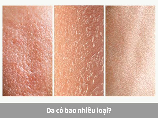 Da mặt được chia thành 5 loại cơ bản
